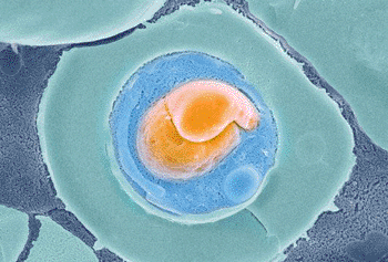 Image: Colored scanning electron micrograph (SEM) of a freeze-fractured red blood cell (erythrocyte, green) infected with a Plasmodium falciparum protozoan (orange and blue) (Photo courtesy of the NIBSC).